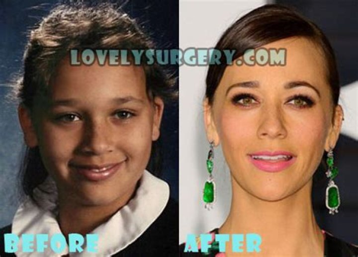 Rashida Jones Plastic Surgery: Before And After Photos